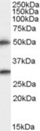 Antibody staining (0.5 ug/ml) of Human Brain (Cerebral Cortex) lysate (RIPA buffer, 35 ug total protein per lane). Primary incubated for 1 hour. Detected by Western blot of chemiluminescence.