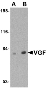 Western blot of VGF in human brain tissue lysate with VGF antibody at (A) 0.5 and (B) 1 ug/ml.