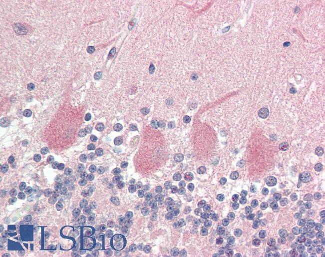 Human Brain, Cerebellum: Formalin-Fixed, Paraffin-Embedded (FFPE)