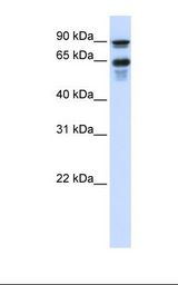 Transfected 293T cell lysate. Antibody concentration: 1.0 ug/ml. Gel concentration: 12%.