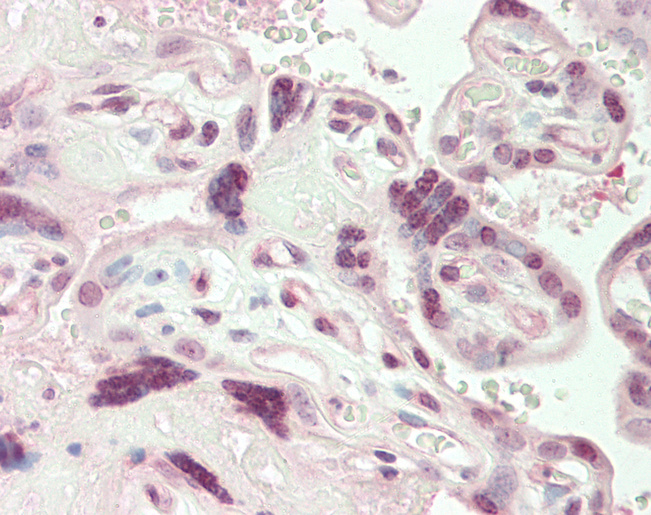 Human Placenta: Formalin-Fixed, Paraffin-Embedded (FFPE)