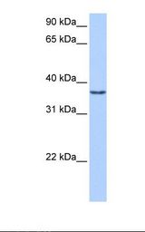 Fetal heart cell lysate. Antibody concentration: 0.5 ug/ml. Gel concentration: 12%.