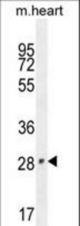 VGLL2 Antibody western blot of mouse heart tissue lysates (35 ug/lane). The VGLL2 antibody detected the VGLL2 protein (arrow).