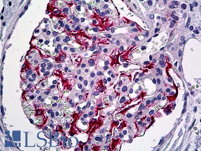 Anti-VHL antibody IHC of human kidney. Immunohistochemistry of formalin-fixed, paraffin-embedded tissue after heat-induced antigen retrieval. Antibody LS-B5361 concentration 5 ug/ml.