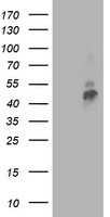 HEK293T cells were transfected with the pCMV6-ENTRY control (Left lane) or pCMV6-ENTRY TMPRSS5 (Right lane) cDNA for 48 hrs and lysed. Equivalent amounts of cell lysates (5 ug per lane) were separated by SDS-PAGE and immunoblotted with anti-TMPRSS5.