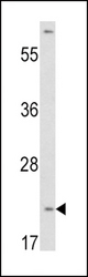 Western blot of VHL antibody in HepG2 cell line lysates (35 ug/lane). VHL (arrow) was detected using the purified antibody.