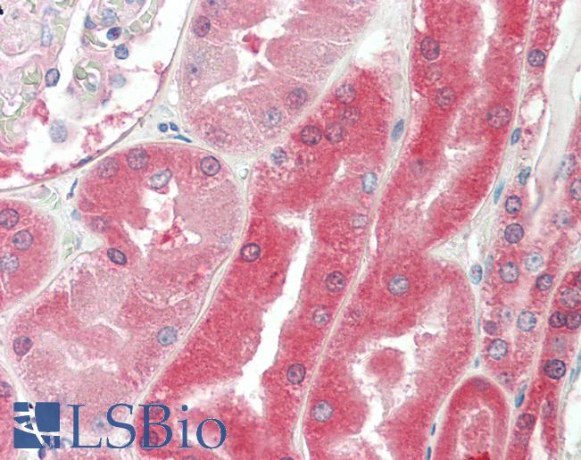 Anti-VHL / Von Hippel Lindau antibody IHC staining of human kidney. Immunohistochemistry of formalin-fixed, paraffin-embedded tissue after heat-induced antigen retrieval. Antibody LS-B10235 concentration 5 ug/ml.