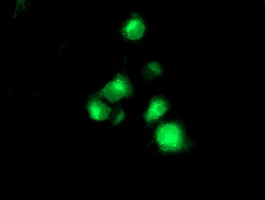 Anti-TMPRSS5 mouse monoclonal antibody immunofluorescent staining of COS7 cells transiently transfected by pCMV6-ENTRY TMPRSS5.