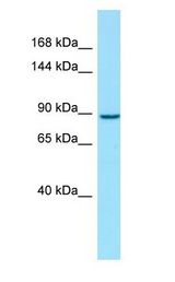 VIL1 / Villin antibody Western Blot of Fetal Liver.