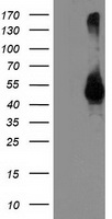 HEK293T cells were transfected with the pCMV6-ENTRY control (Left lane) or pCMV6-ENTRY TMPRSS5 (Right lane) cDNA for 48 hrs and lysed. Equivalent amounts of cell lysates (5 ug per lane) were separated by SDS-PAGE and immunoblotted with anti-TMPRSS5.