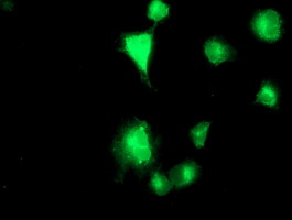 Anti-TMPRSS5 mouse monoclonal antibody immunofluorescent staining of COS7 cells transiently transfected by pCMV6-ENTRY TMPRSS5.