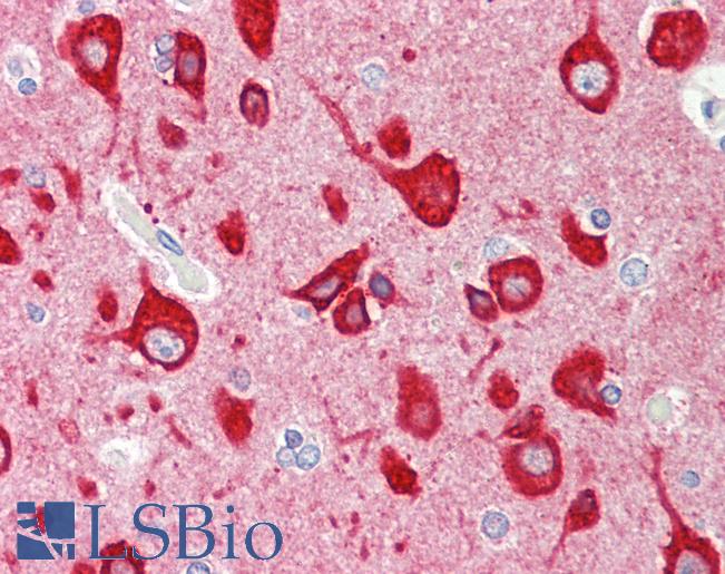 Anti-VILIP / VSNL1 antibody IHC staining of human brain, cortex. Immunohistochemistry of formalin-fixed, paraffin-embedded tissue after heat-induced antigen retrieval.