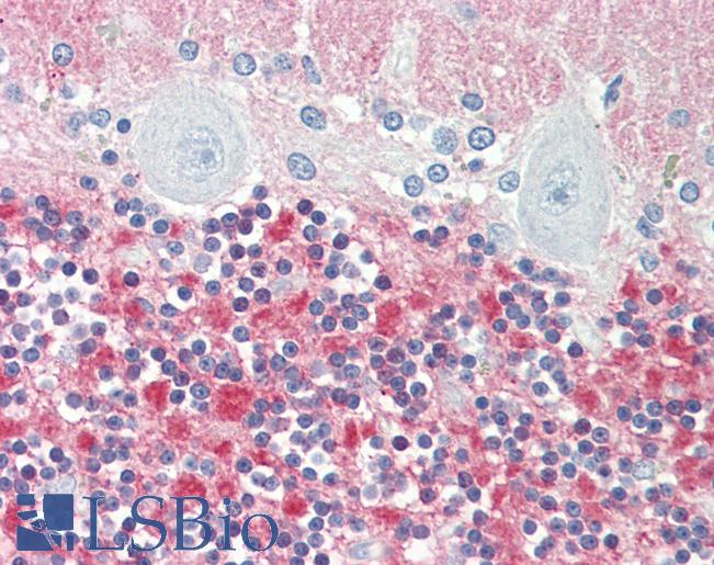 Anti-VILIP / VSNL1 antibody IHC staining of human brain, cerebellum. Immunohistochemistry of formalin-fixed, paraffin-embedded tissue after heat-induced antigen retrieval.