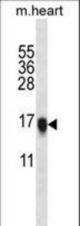 VSNL1 Antibody western blot of mouse heart tissue lysates (35 ug/lane). The VSNL1 antibody detected the VSNL1 protein (arrow).