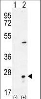 Western blot of VSNL1 (arrow) using rabbit polyclonal VSNL1 Antibody. 293 cell lysates (2 ug/lane) either nontransfected (Lane 1) or transiently transfected (Lane 2) with the VSNL1 gene.