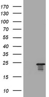 HEK293T cells were transfected with the pCMV6-ENTRY control (Left lane) or pCMV6-ENTRY VSNL1 (Right lane) cDNA for 48 hrs and lysed. Equivalent amounts of cell lysates (5 ug per lane) were separated by SDS-PAGE and immunoblotted with anti-VSNL1.