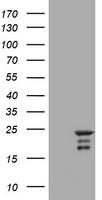 HEK293T cells were transfected with the pCMV6-ENTRY control (Left lane) or pCMV6-ENTRY VSNL1 (Right lane) cDNA for 48 hrs and lysed. Equivalent amounts of cell lysates (5 ug per lane) were separated by SDS-PAGE and immunoblotted with anti-VSNL1.