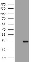 HEK293T cells were transfected with the pCMV6-ENTRY control (Left lane) or pCMV6-ENTRY VSNL1 (Right lane) cDNA for 48 hrs and lysed. Equivalent amounts of cell lysates (5 ug per lane) were separated by SDS-PAGE and immunoblotted with anti-VSNL1.