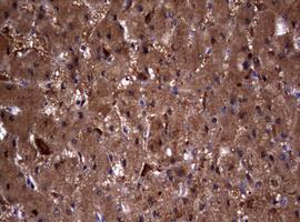 IHC of paraffin-embedded Human liver tissue using anti-VSNL1 mouse monoclonal antibody. (Heat-induced epitope retrieval by 10mM citric buffer, pH6.0, 120°C for 3min).