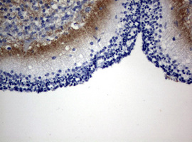 IHC of paraffin-embedded Human embryonic cerebellum using anti-VSNL1 mouse monoclonal antibody. (Heat-induced epitope retrieval by 10mM citric buffer, pH6.0, 120°C for 3min).