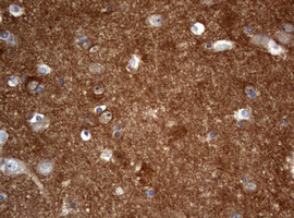 IHC of paraffin-embedded Human adult brain tissue using anti-VSNL1 mouse monoclonal antibody. (Heat-induced epitope retrieval by 10mM citric buffer, pH6.0, 120°C for 3min).