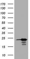 HEK293T cells were transfected with the pCMV6-ENTRY control (Left lane) or pCMV6-ENTRY VSNL1 (Right lane) cDNA for 48 hrs and lysed. Equivalent amounts of cell lysates (5 ug per lane) were separated by SDS-PAGE and immunoblotted with anti-VSNL1.