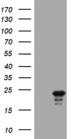 HEK293T cells were transfected with the pCMV6-ENTRY control (Left lane) or pCMV6-ENTRY VSNL1 (Right lane) cDNA for 48 hrs and lysed. Equivalent amounts of cell lysates (5 ug per lane) were separated by SDS-PAGE and immunoblotted with anti-VSNL1.