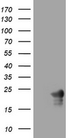 HEK293T cells were transfected with the pCMV6-ENTRY control (Left lane) or pCMV6-ENTRY VSNL1 (Right lane) cDNA for 48 hrs and lysed. Equivalent amounts of cell lysates (5 ug per lane) were separated by SDS-PAGE and immunoblotted with anti-VSNL1.