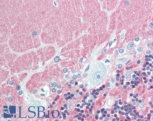 Anti-VILIP / VSNL1 antibody IHC staining of human brain, cerebellum. Immunohistochemistry of formalin-fixed, paraffin-embedded tissue after heat-induced antigen retrieval. Antibody LS-B10418 dilution 1:100.