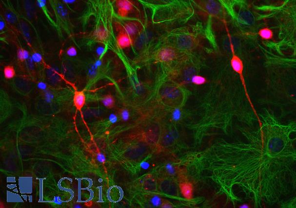 Neuron-glia cell culture stained with VILIP / VSNL1 antibody (red), monoclonal antibody to GFAP (green) and DNA (blue). The VILIP / VSNL1 antibody reveals strong staining throughout some small neurons in soma and all processes, accumulation is seen in some hot spots along neurites. GFAP appears only in astrocytes.