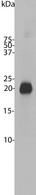 Western blot of bovine cerebellum homogenate stained with VILIP / VSNL1 antibody. Note the strong clean band running at 22 kDa.