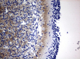 IHC of paraffin-embedded Human embryonic cerebellum using anti-VSNL1 mouse monoclonal antibody. (Heat-induced epitope retrieval by 10mM citric buffer, pH6.0, 120°C for 3min).