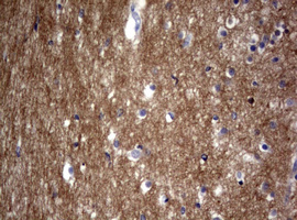 IHC of paraffin-embedded Human embryonic brain cortex tissue using anti-VSNL1 mouse monoclonal antibody. (Heat-induced epitope retrieval by 10mM citric buffer, pH6.0, 120°C for 3min).