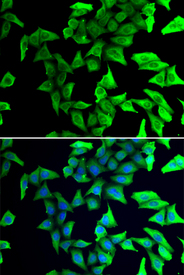 Immunofluorescence blot of U20S cell using VSNL1 antibody. Blue: DAPI for nuclear staining.