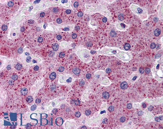 Anti-TMPRSS6 antibody IHC of human liver. Immunohistochemistry of formalin-fixed, paraffin-embedded tissue after heat-induced antigen retrieval. Antibody LS-B5835 concentration 5 ug/ml.