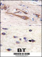 Formalin-fixed and paraffin-embedded human brain tissue reacted with VILIP1 antibody (C-term ), which was peroxidase-conjugated to the secondary antibody, followed by DAB staining. This data demonstrates the use of this antibody for immunohistochemistry; clinical relevance has not been evaluated.
