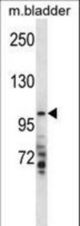 TMPRSS7 Antibody western blot of mouse bladder tissue lysates (35 ug/lane). The TMPRSS7 antibody detected the TMPRSS7 protein (arrow).