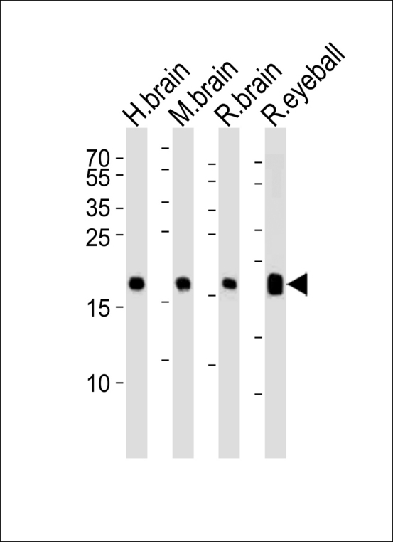 Western blot of lysates from human brain, mouse brain, rat brain and rat eyeball tissue lysate (from left to right), using VILIP1 Antibody. Antibody was diluted at 1:1000 at each lane. A goat anti-rabbit IgG H&L (HRP) at 1:5000 dilution was used as the secondary antibody. Lysates at 35ug per lane.