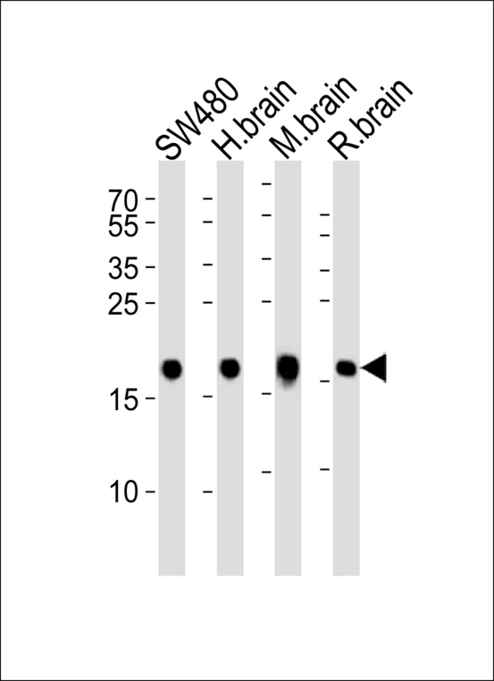 Western blot of lysates from SW480 cell line, human brain, mouse brain and rat brain tissue lysate(from left to right), using VILIP1 Antibody. Antibody was diluted at 1:1000 at each lane. A goat anti-rabbit IgG H&L (HRP) at 1:5000 dilution was used as the secondary antibody. Lysates at 35ug per lane.