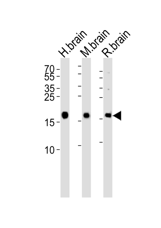 Western blot of lysates from human brain, mouse brain and rat brain tissue lysate (from left to right), using VILIP1 Antibody. Antibody was diluted at 1:1000 at each lane. A goat anti-rabbit IgG H&L (HRP) at 1:5000 dilution was used as the secondary antibody. Lysates at 35ug per lane.