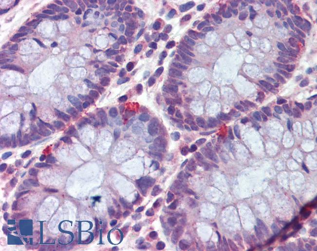 Anti-VIP antibody IHC of human colon. Immunohistochemistry of formalin-fixed, paraffin-embedded tissue after heat-induced antigen retrieval. Antibody LS-B3634 concentration 10 ug/ml.