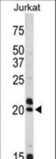Western blot of VIP antibody in Jurkat cell line lysates (35 ug/lane). VIP (arrow) was detected using the purified antibody.