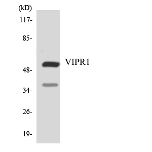 Western blot of the lysates from HeLa cells using VIPR1 antibody.