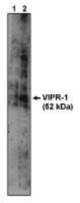 Western blot of anti-VIPR1 antibody on A431 cell lysate at 1 ug/ml (1) and 10 ug/ml (2).