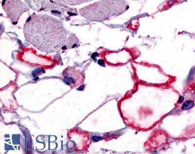 Anti-VIP Receptor 1 antibody LS-A1297 IHC of human adipocytes. Immunohistochemistry of formalin-fixed, paraffin-embedded tissue after heat-induced antigen retrieval.