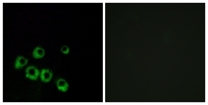 Immunofluorescence of MCF7 cells, using VIPR1 Antibody. The picture on the right is treated with the synthesized peptide.