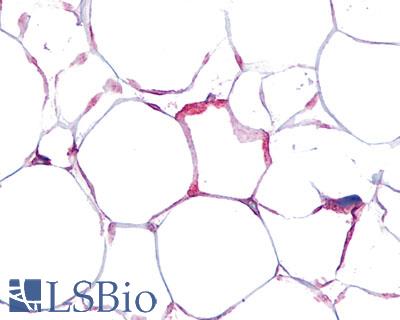 Anti-VIP Receptor 1 antibody LS-A1296 IHC of human adipocytes. Immunohistochemistry of formalin-fixed, paraffin-embedded tissue after heat-induced antigen retrieval.