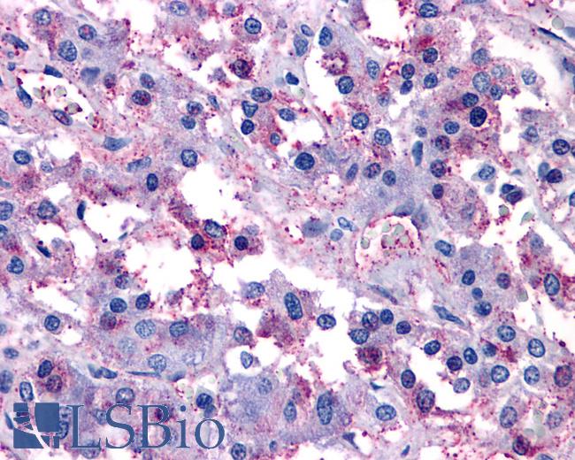 Anti-VIPR1 / RDC1 antibody IHC of human adrenal. Immunohistochemistry of formalin-fixed, paraffin-embedded tissue after heat-induced antigen retrieval.