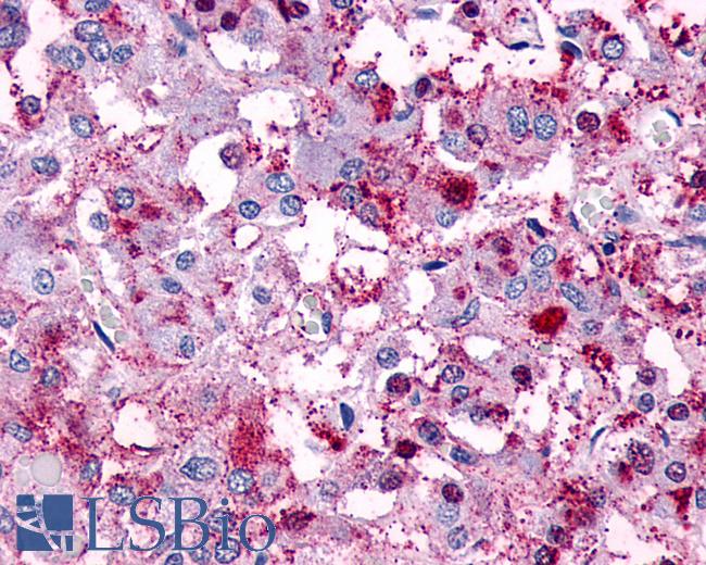 Anti-VIPR1 / RDC1 antibody IHC of human adrenal. Immunohistochemistry of formalin-fixed, paraffin-embedded tissue after heat-induced antigen retrieval.