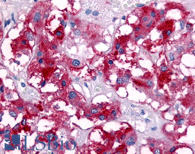 Anti-VIP Receptor 1 antibody LS-A3589 IHC of human adrenal medulla. Immunohistochemistry of formalin-fixed, paraffin-embedded tissue after heat-induced antigen retrieval.